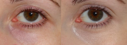 Lancome Effacernes Longue Tenue Concealer  SPF12