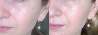 Kiehl's Actively Correcting & Beautifying BB Cream SPF 50+ PA в оттенке 1 Fair