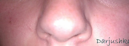 Как я побеждала покраснения своей кожи с помощью Clinique Redness Solutions Instant Relief Mineral Pressed Powder