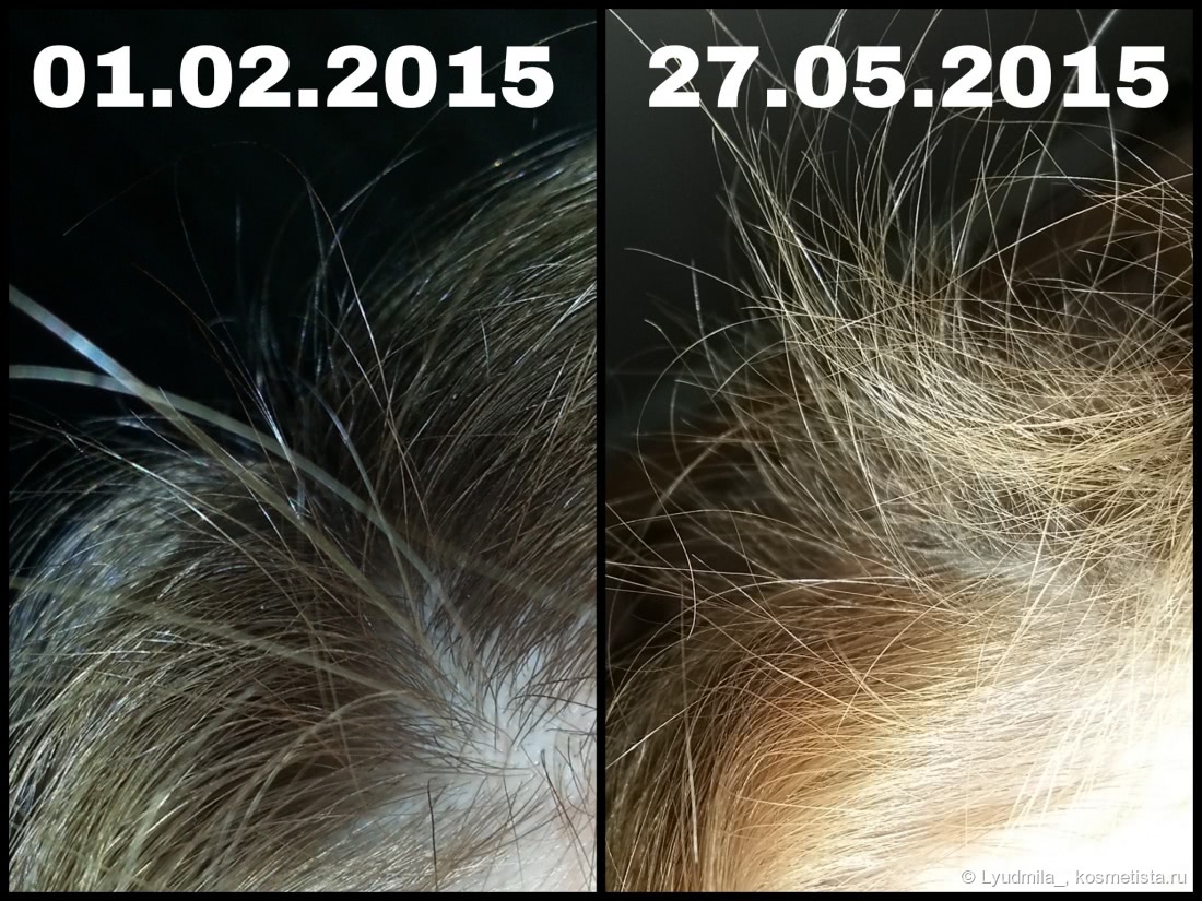 Масло брами при выпадении волос