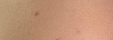 Lancome Effacernes Longue Tenue, Estee Lauder Ideal Light, Yves Rocher Корректор «Ноль Недостатков», Clinique Anti-Blemish Solutions Сlearing Сoncealer