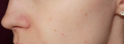 Lancome Hydra Zen Teinte Neurocalm SPF 15 – Увлажняющий крем с тонирующим эффектом, оттенок 1 Naturel