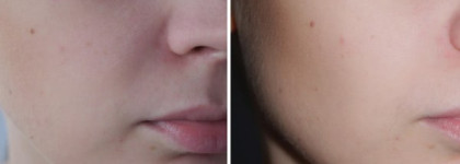 Clinique Blended Face Powder And Brush,  Pupa Luminys Baked Face Powder & Yves Rocher Colors Pressed Powder Compact