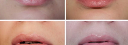 Набор Korres Love Your Lips Collection