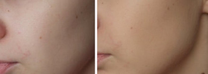 Skin79 BB Cream Miniature Set Black