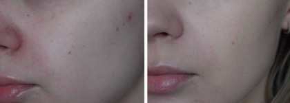 Shiseido The Skincare Tinted Moisture Protection SPF 20 – Тонирующая эмульсия СПФ 20 оттенок  №1 – light clair