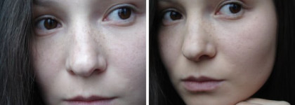 Совершенные продукты для несовершенной кожи