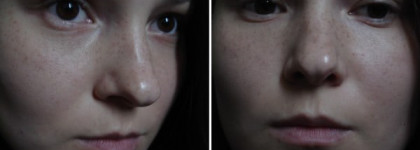 Совершенные продукты для несовершенной кожи