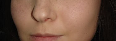 Совершенные продукты для несовершенной кожи