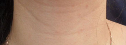 Разглаживающая сыворотка Now Foods Solutions Hyaluronic Acid Firming Serum