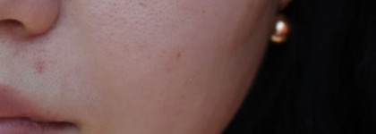 3 продукта от Clinique и 1 от Chanel