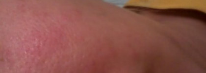 Мое разочарование: Clean & Clear Нежный Уход