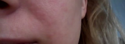 Мое разочарование: Clean & Clear Нежный Уход