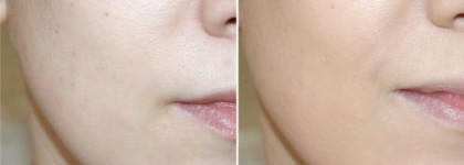 BB Cream Секрет Совершенства в оттенке Light от Garnier