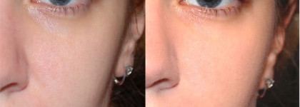 Новые горизонты с Diorskin Forever от Christian Dior № 020 Beige clair