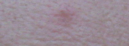 Маскирующее средство от прыщей Collistar — Collistar S.O.S Blemishes / Collistar S.O.S.Imperfezioni