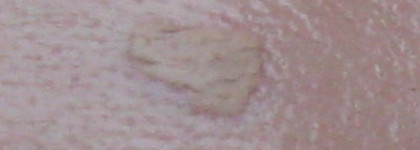 Маскирующее средство от прыщей Collistar — Collistar S.O.S Blemishes / Collistar S.O.S.Imperfezioni