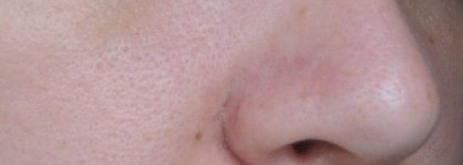 Тональный матирующий бальзам для лица Benefit dr. feelgood