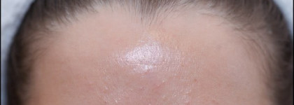 Миндальный салонный пилинг Egia