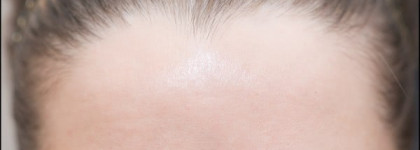 Миндальный салонный пилинг Egia