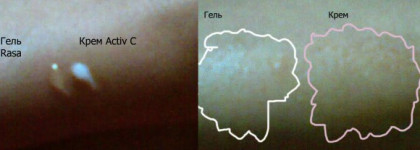 Уход за самой нежной кожей вокруг глаз