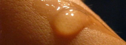 Всегда в моей сумке - Arnica Essentiel Гель-SOS "Чистые Руки" от Yves Rocher