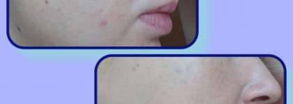 Немного корейского ухода от Mizon  и Face it и BB крем от the FaceShop