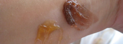 Гели для интенсивного загара: Lancaster VS Bottega Verde