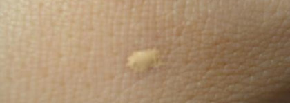 Тональная основа Lancome Teint Miracle spf 15 в оттенке 01 Beige Albatre