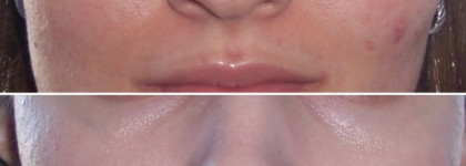 Разбор bb крема Lancome UV Expert GN-Shield High Potency Active Protection BB Base SPF 50 PA+++