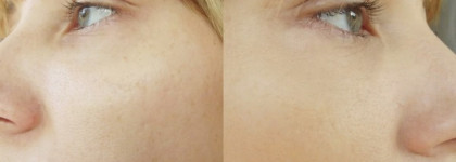 Dior Capture Totale High Definition Serum Foundation SPF 15 в оттенке 23 peach