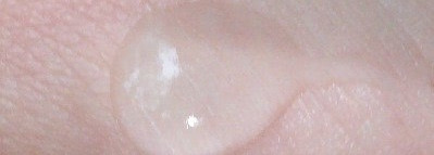 Средства локального применения против воспалений. Оружие, бьющее точно в цель?