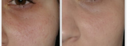 Незаменимые два средства в моём макияже от Clinique