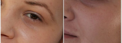 SkinFood Aloe Sun BB Cream SPF 20 PA + Food Therapy в оттенке 1 Light Beige