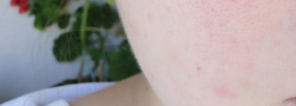 Скрываем поры с Idealist Pore Minimizing Skin Refinisher