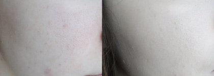 Красивая кожа с бб-кремом Dr.Jart+ rejuvenating blemish base silver label