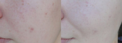 Clarins The Skin Illusions Mineral & Plant Extracts Loose Powder Foundation – Минеральная рассыпчатая пудра-основа, придающая сияние коже (103)