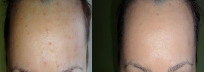 Фотошоп? Нет! Это Chanel Vitalumiere Aqua Fresh and Hydrating Cream Compact Makeup with Spf15 в оттенке 30 beige