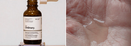 Сыворотки The Ordinary: ретиноиды, пептиды и балансирование кожи