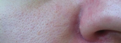 Ваши советы по уходу за вот такой вот кожей