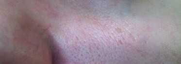 Ваши советы по уходу за вот такой вот кожей