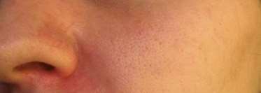 Ваши советы по уходу за вот такой вот кожей