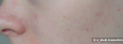 Essence Forget It! 3 in 1 Concealer - Палитра консилеров