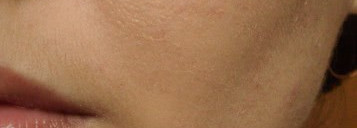 Быть или не быть? Тональный крем для проблемной кожи Clinique Anti-Blemish Solutions Liquid Makeup 01 fresh alabaster