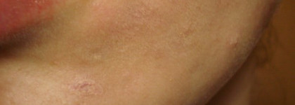Маскирующий карандаш для проблемной кожи Clinique Anti-blemish Solutions Clearing Consealer (shade 01)
