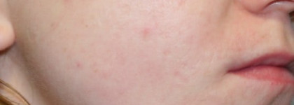 Бб-крем Skinfood Red Bean BB Cream Spf20 №1