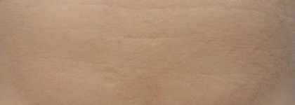 Заполнитель морщин  МАС prep+prime line filler base lissante