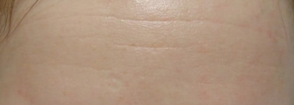 Заполнитель морщин  МАС prep+prime line filler base lissante