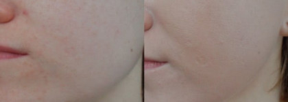 Nature Republic By Flower B.B Cream Spf35 PA++ 01 pink beige