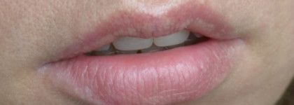 Clarins Joli Baume Éclat du Jour -  запах, напоминающий лето